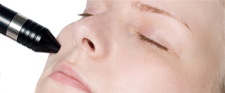microdermabrasie
